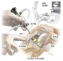 全身关节响是怎么回事?
