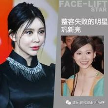 打肉毒素变面瘫,那些血淋淋的整容失败案例