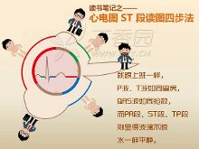 漫画心电图:ST?段读图四步法