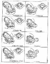 胎体纵轴与母体纵轴的关系称胎产式(见图5-3).