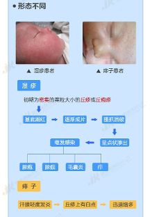 皮肤专科医院：守护你的美丽与健康
