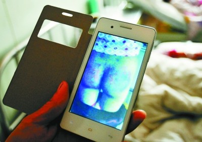 小学老师铁铲狂抽女生臀部致昏迷